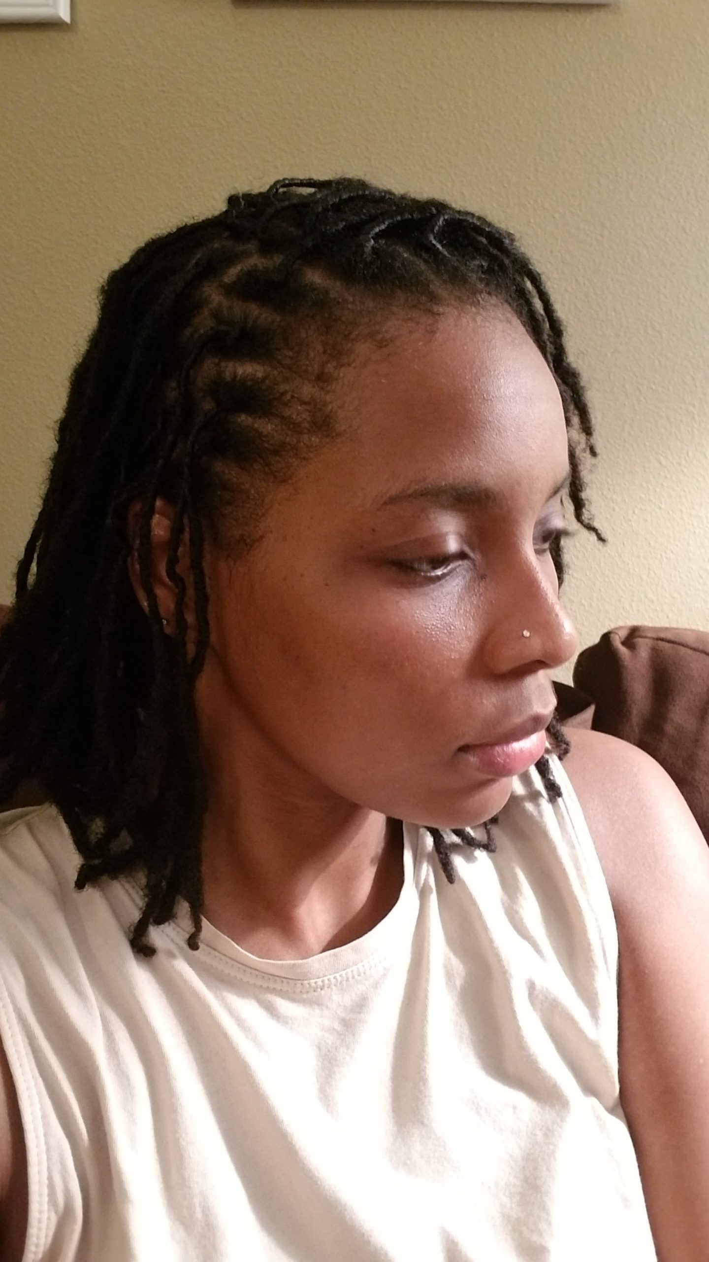 24+ How To Fix Thinning Dreads - NeveenDilyn